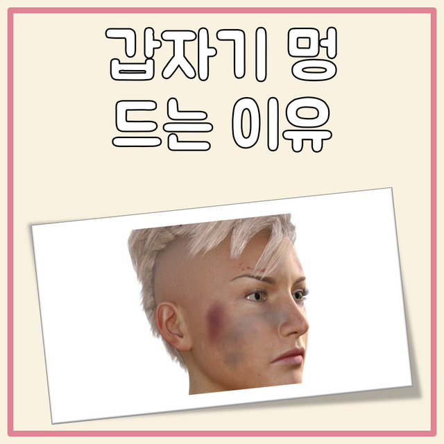 갑자기 멍 드는 이유 걱정되신다면 참고해보세요