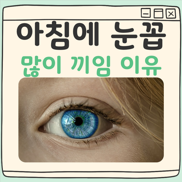 아침에 눈꼽 많이 끼임 대표 이미지