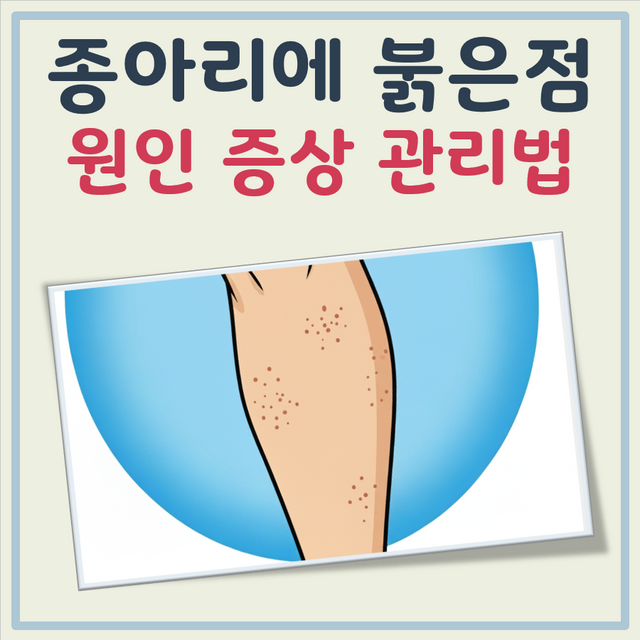 종아리에 붉은점 원인 증상 관리 방법 대표 이미지