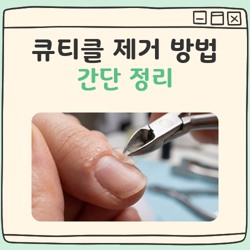 큐티클 제거 방법 대표 이미지